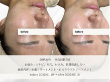 エメ(aimer)/SkinCare《肌管理・エイジング》