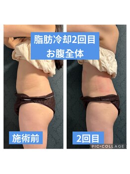 パラアモール(Paraamor)/お腹の出っ張りが軽減◎