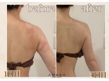 アンバー 恵比寿(AMBER)/駆け込みブライダルの方にも◎