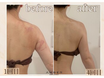 アンバー 恵比寿(AMBER)/駆け込みブライダルの方にも◎