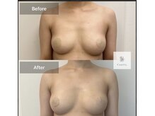 エルミナ.(elmina.)/サイズアップ♪どんどん育つ！