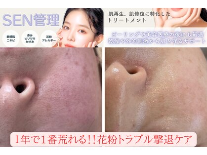 レピア(Le'pia)の写真