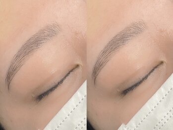 エフイム 亀有店の写真/丁寧なカウンセリング+施術で理想の目元へ!眉スタイリング×顔脱毛のセットで、パッと明るい透明感肌に♪