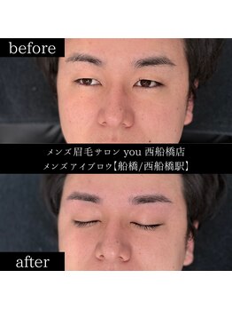 ユー 西船橋店(you)/ビフォーアフターお写真