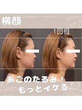 ラフィズム 竹ノ塚店(Raphism)/横顔美人☆