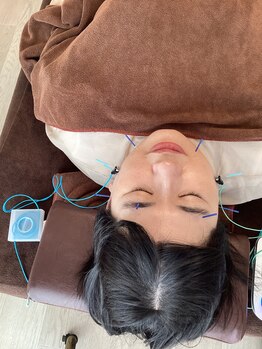 ハリファ鍼灸院 横浜関内院(HariFa鍼灸院)/美容施術