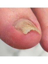 001 新横浜/こんなに急角度でもOKです