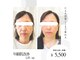 トータルスキンケア キュララ(Kyurara)の写真