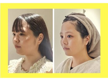 アン 銀座(ann)/レモンボトル