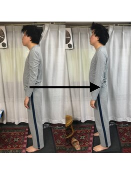 新橋整体グッドラックカイロプラクティック(Good Luck)/全身の調整をしてスッと立つ姿勢