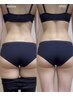 《全身美変身》顔・体フルコース★贅沢マシン2種で全身徹底アプローチ