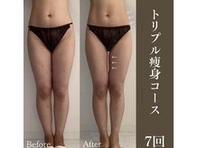 サロンドペシェ(salon de peche)/30代/痩身60分7回の変化