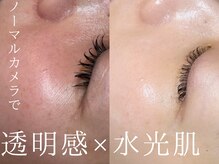 ルーツリー(Rootree)の雰囲気（パーソナルな肌質改善＊お客様ひとりひとりに合わせた施術）