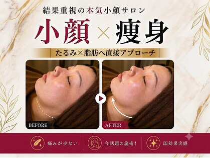 【小顔・痩身専門店】Lift静岡【6/30 OPEN（予定）】の写真