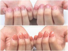 ネイルサロン オー(Oh!)/劇 的☆深爪改善！Before→After