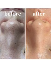 スピカ(Spica)/ここまでキレイになりました♪