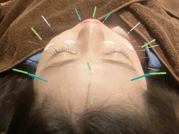 ビビオンリーワン 銀座築地(vivi only one)の写真/【痛みの少ない美容鍼】初めての方にもオススメ☆たるみやしわの改善/くすみ/エラの張り/コリ/むくみに◎