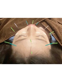 ハリツヤをUPしたい