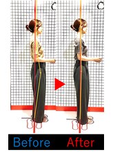 池袋東鍼灸整骨院/姿勢写真