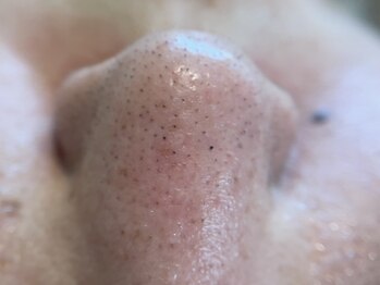 リセットプラス(Reset+)/