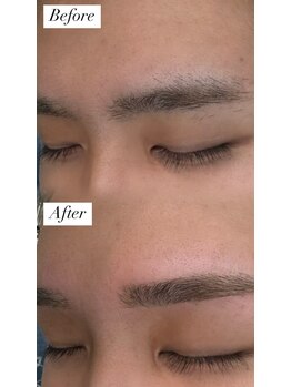 ビュー テンジン 天神 大名(VIEW TENJIN)/アイブロウ（眉毛）ワックス脱毛