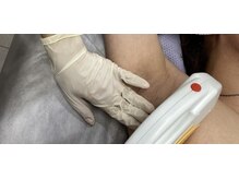 クラフト フェリーチェ 横芝店(CRAFT×felice)の雰囲気（冷たい照射面で痛み、熱さを感じずに脱毛出来ます）