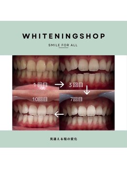 ホワイトニングショップ 刈谷店/【汚れもつきにくくしてくれる】