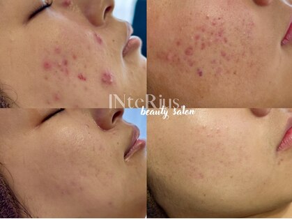 インテリウス(INteRius.)の写真