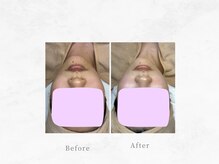 ジーンバイピエル 中野店(gene by PIEL)