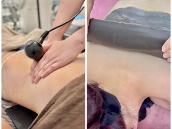 シェリートーキョー 成田店(Cherie Tokyo)の写真/お腹周りの集中ケア×ハーブ温熱泥湿布＋ラジオ波で、スッキリとした理想のボディラインへ。