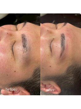 マグ 藤枝店(Mag)/アイブロウビフォーアフター