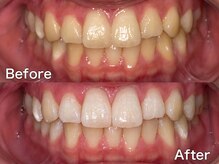 バイエムディーシー(by MDC)/【Before / After】