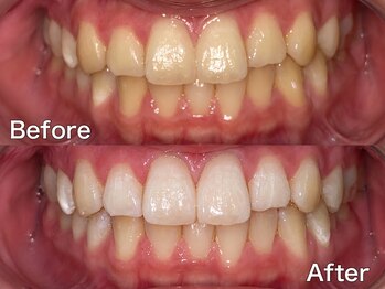 バイエムディーシー(by MDC)/【Before / After】