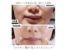 アンジー(an.g)の雰囲気（【弾むようなハリツヤ肌へ】韓国美肌になる◎【御幸/府中】）