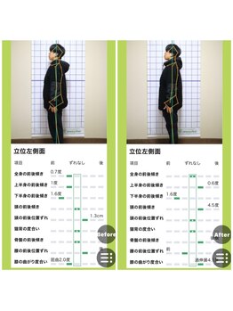 ニコラ(NICORA)/AI診断（姿勢分析）2