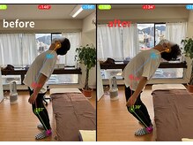 アオ整体院/腰痛のお客様ビフォーアフター☆