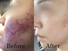 ビ ボーテ(美 Beaute)/根本改善をサポート