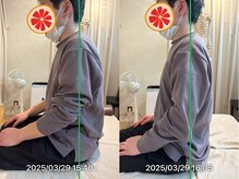 グレフル鍼灸接骨院 整体院 心斎橋/