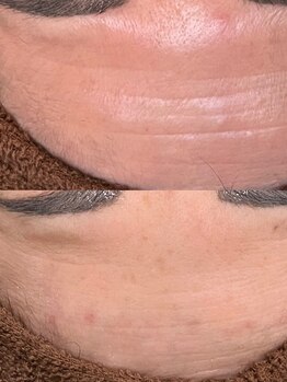 オンケイ(ONKEI)/敏感肌は改善します