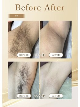 ポノ アンド マルン(Pono&Marun)/