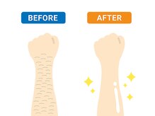 メンズラボ(Men's Lab)/脱毛は今からスタートが最適