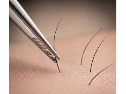 チャームプラス(CHARM+)の写真