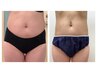 【脂肪撃退!お腹ぽっこり内臓脂肪たっぷり】90分脂肪燃焼 ¥37,400→¥24,200