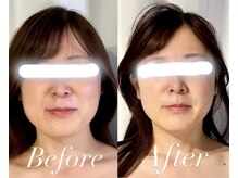 サロンドベベ(salon de Bebe.)の雰囲気(施術1回.オーダーメイド施術であなたの魅力を最大限引き出します)