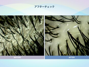 アンス(anth:)/お客様の仕上がり