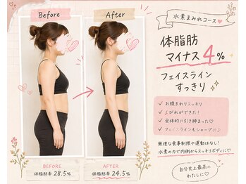 ヨサパーク ラプラス(YOSA PARK Laplace)の写真/理想の美脚へ！むくみにさようなら！脂肪燃焼と代謝アップを実感☆