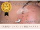 グロッシー(glossy)の写真