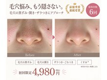オレオマ(OLEOMA)