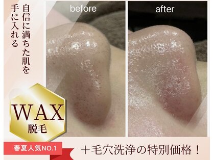 サンカリビューティー(SANKARI beauty)の写真