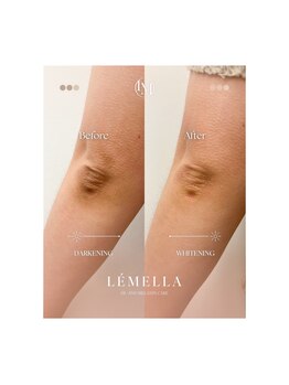 ピュアソル 奈良店(Puresol)/ルメラ